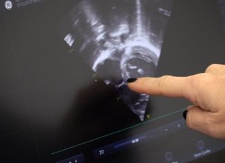 Si fa prevenzione all'Itis "Volta" di Perugia con "La Gloria nel Cuore"