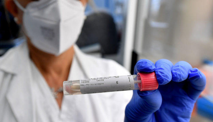 CORONAVIRUS: LABORATORIO ANALISI COVID